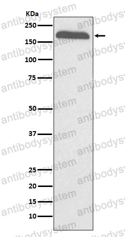 Anti-A2M Antibody (R1H57)