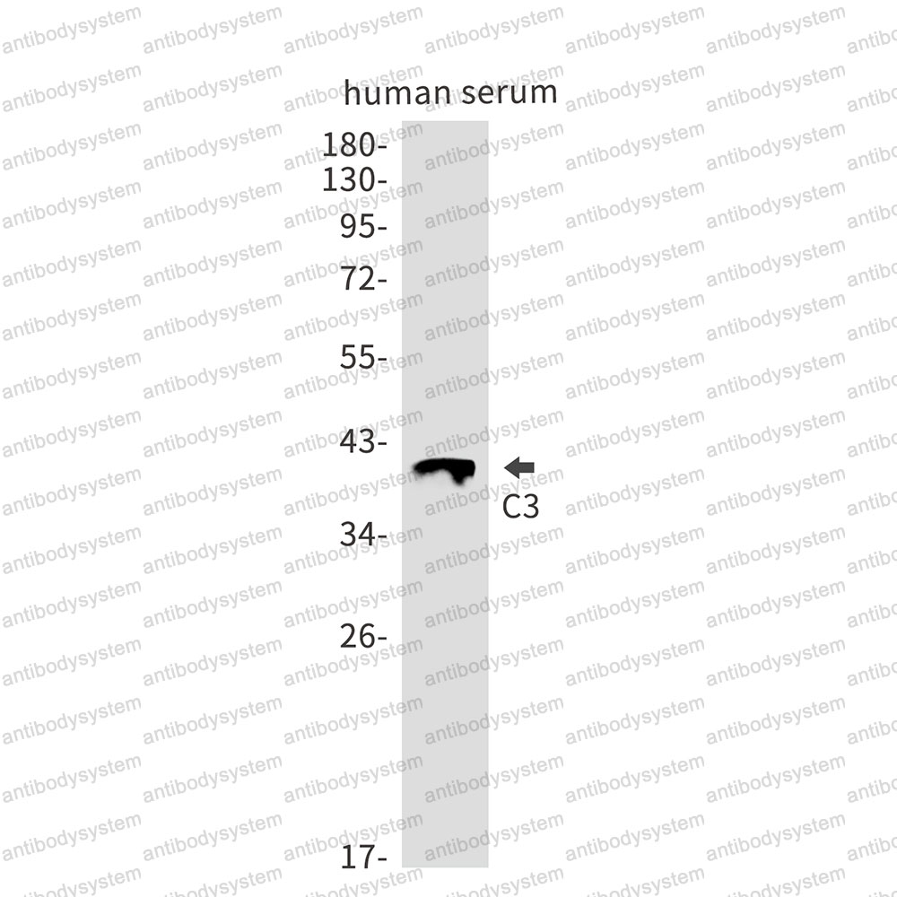 Anti-C3/Complement C3 Antibody (R1H58)