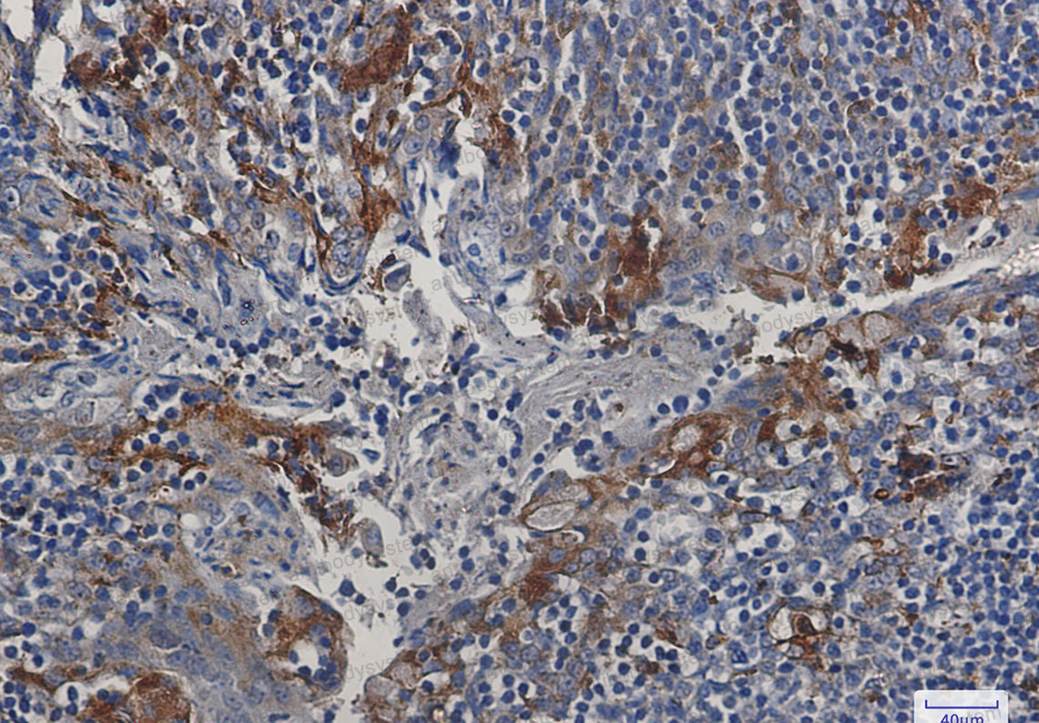 Anti-CST3 Antibody (R1H62)