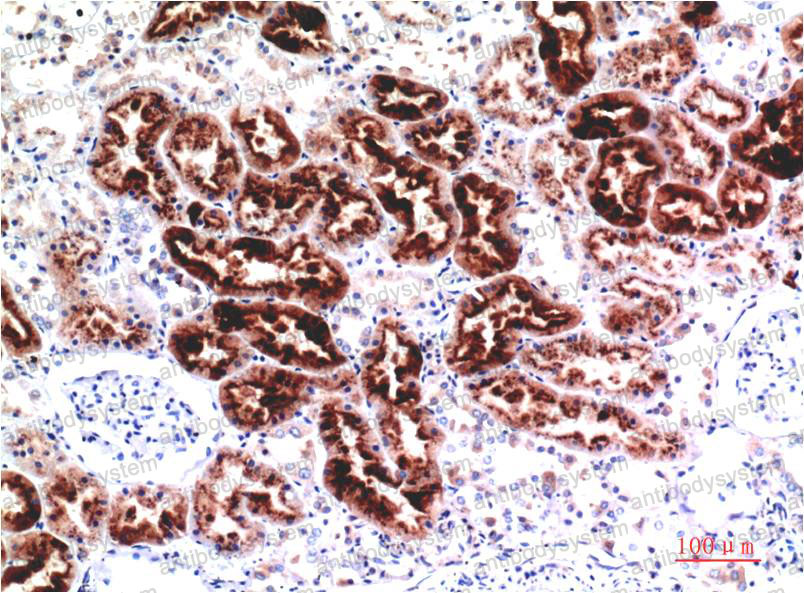 Immunohistochemical for Anti-CST3 Antibody (R2X04) ?>