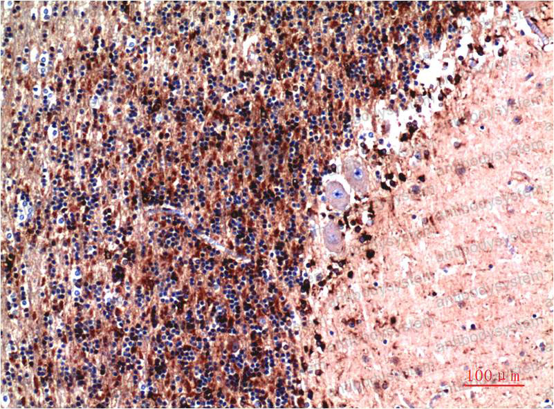 Immunohistochemical for Anti-CST3 Antibody (R2X04) ?>