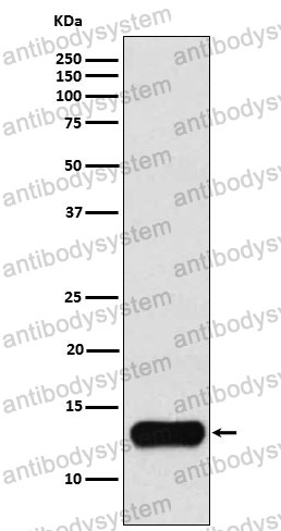 Anti-CSTA Antibody (R1H63)