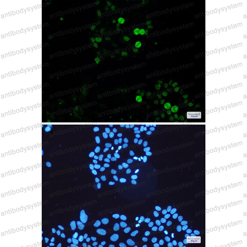 Anti-Phospho-c-Myc (Ser62) Antibody (R1H65)