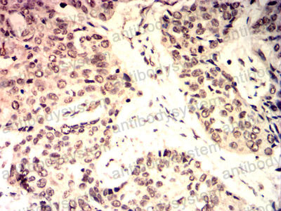 Immunohistochemical for Anti-MYC Antibody (R2X12) ?>