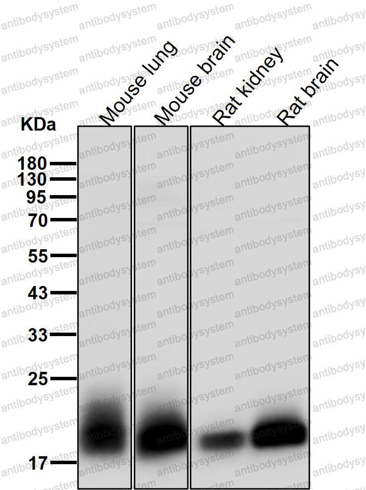Anti-NRAS/Ras Antibody (R1B63)