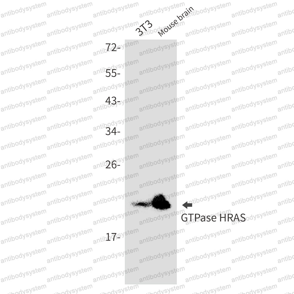 Anti-NRAS Antibody (R1H70)