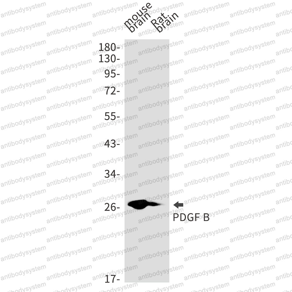 Anti-PDGFB Antibody (R1H71)