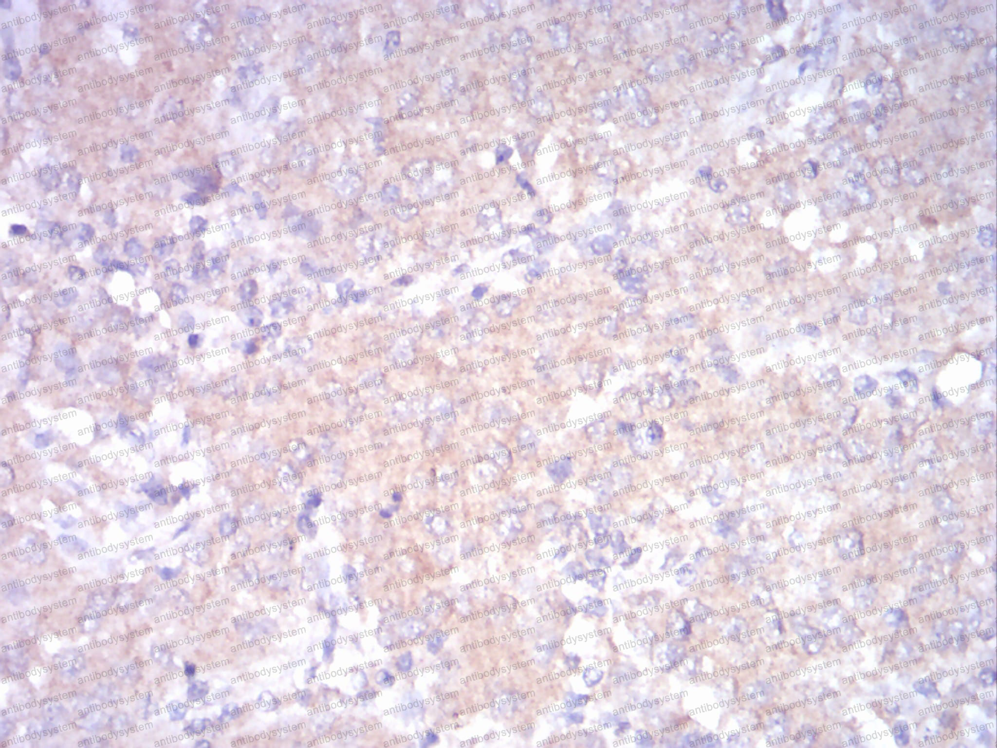 Immunohistochemical for Anti-LDLR Antibody (R2X14) ?>