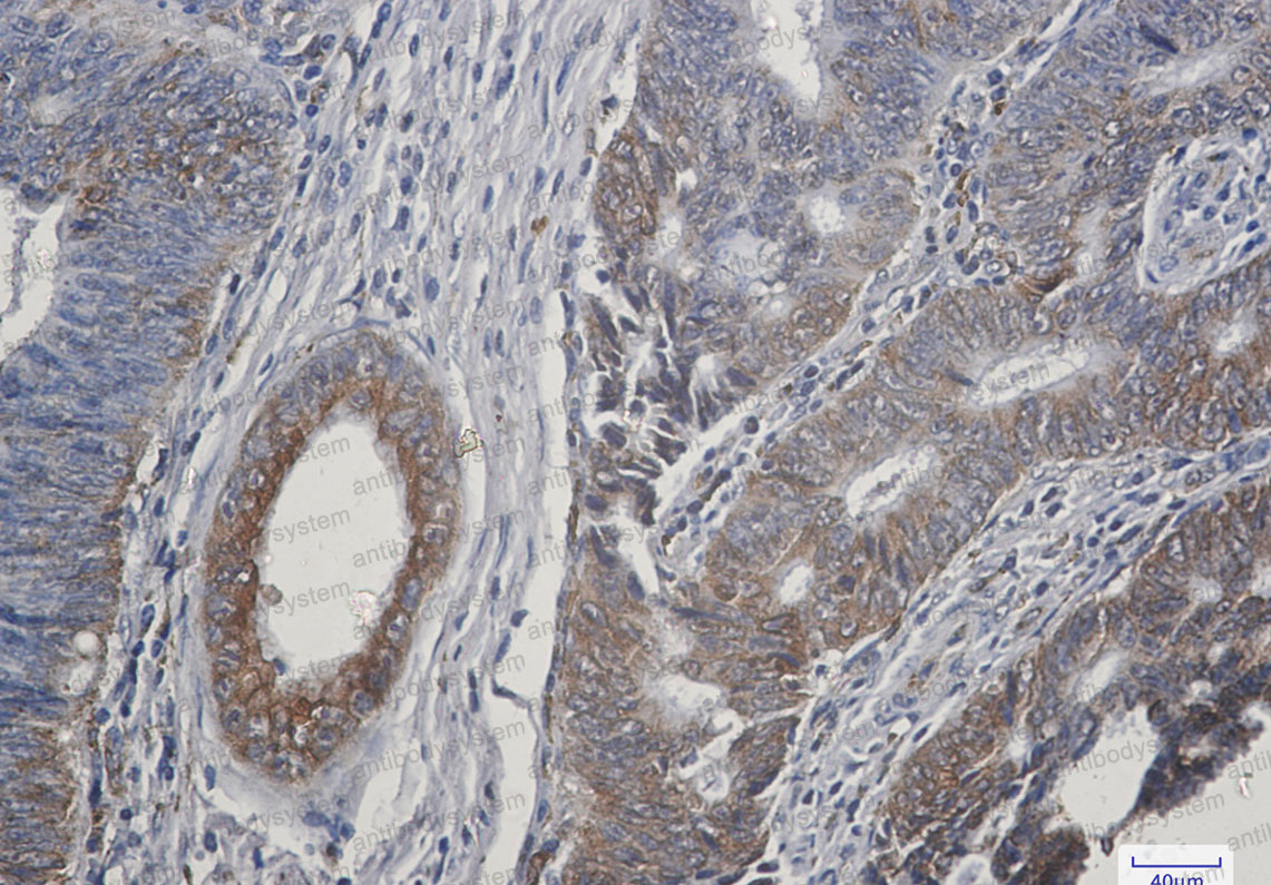 Anti-TGFA/TGF-alpha Antibody (R1H73)