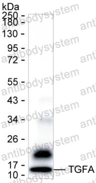 Western blot for Anti-TGFA/TGF-alpha Antibody (R2X18) ?>
