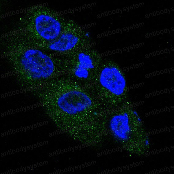 Anti-NGF/Beta-NGF Antibody (R1A91)