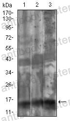 Western blot for Anti-FSHB Antibody (R2X28) ?>