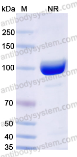 Anti-Human TG/Thyroglobulin Antibody (SAA0534)