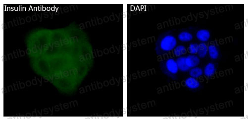 Anti-INS/Insulin Antibody (R1B98)