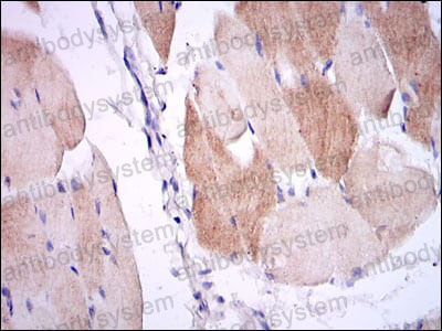 Immunohistochemical for Anti-IL1B/IL1F2 Antibody (R2X46) ?>