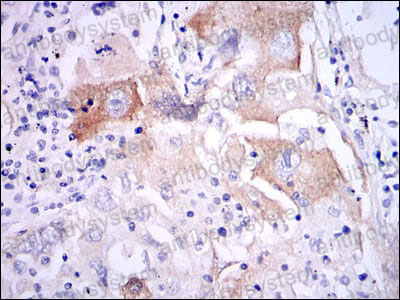 Immunohistochemical for Anti-IL1B/IL1F2 Antibody (R2X46) ?>