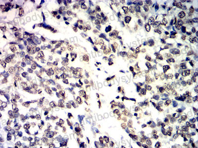 Immunohistochemical for Anti-IL1B/IL1F2 Antibody (R2X48) ?>