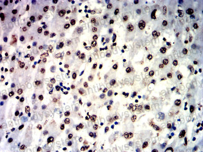 Immunohistochemical for Anti-IL1B/IL1F2 Antibody (R2X48) ?>