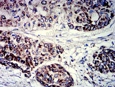 Immunohistochemical for Anti-PIGR Antibody (R2X59) ?>
