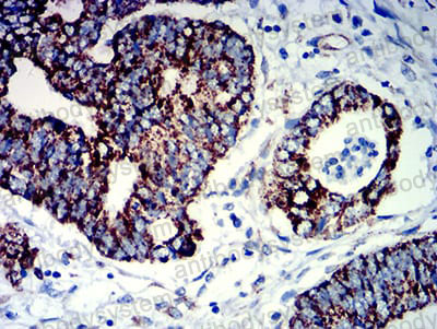 Immunohistochemical for Anti-PIGR Antibody (R2X59) ?>