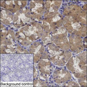 Immunohistochemical for Anti-LAYN/Layilin Antibody (R2X66) ?>