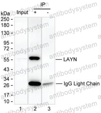 Immunoprecipitation for Anti-LAYN/Layilin Antibody (R2X66) ?>