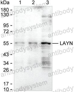 Western blot for Anti-LAYN/Layilin Antibody (R2X66) ?>