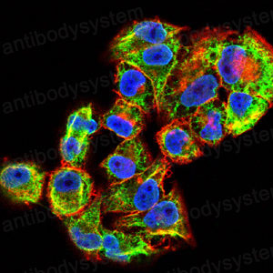 Immunofluorescence for Anti-KRT14 Antibody (R2X89) ?>