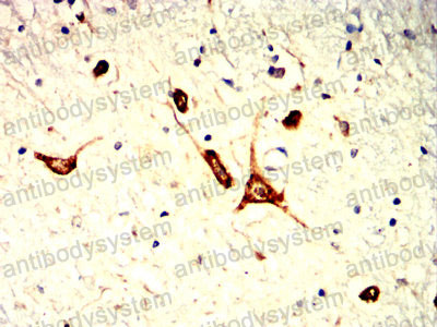 Immunohistochemical for Anti-KRT14 Antibody (R2X89) ?>
