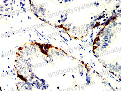 Immunohistochemical for Anti-KRT14 Antibody (R2X89) ?>