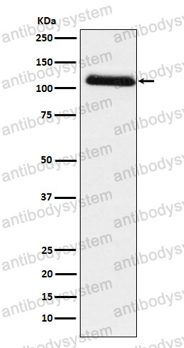 Anti-FGA Antibody (R1H98)