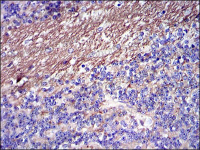 Immunohistochemical for Anti-FGG Antibody (R2Y01) ?>