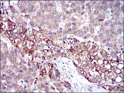 Immunohistochemical for Anti-FGG Antibody (R2Y01) ?>