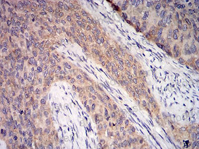 Immunohistochemical for Anti-C1QA Antibody (R2Y06) ?>