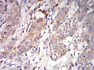 Immunohistochemical for Anti-C1QA Antibody (R2Y06) ?>
