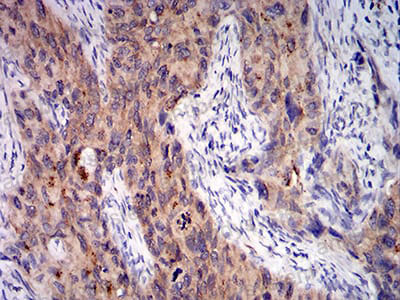 Immunohistochemical for Anti-C1QA Antibody (R2Y07) ?>