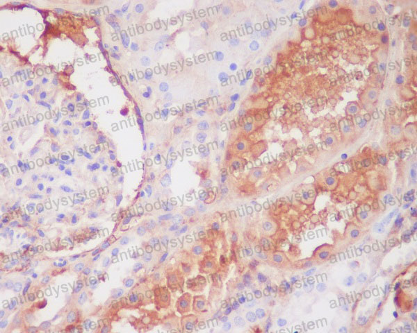 Anti-C9 Antibody (R1A80)