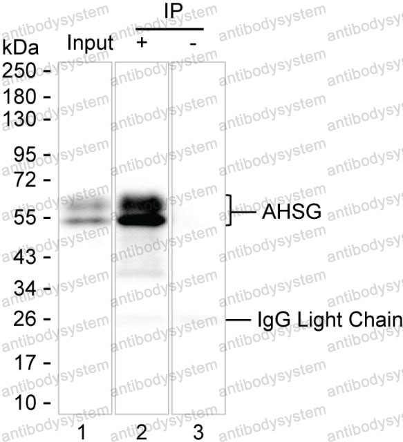 Immunoprecipitation for Anti-AHSG Antibody (R2Y16) ?>
