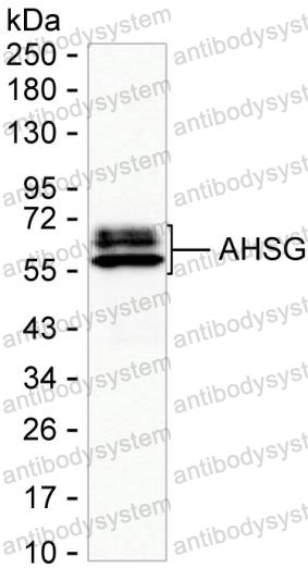 Western blot for Anti-AHSG Antibody (R2Y16) ?>