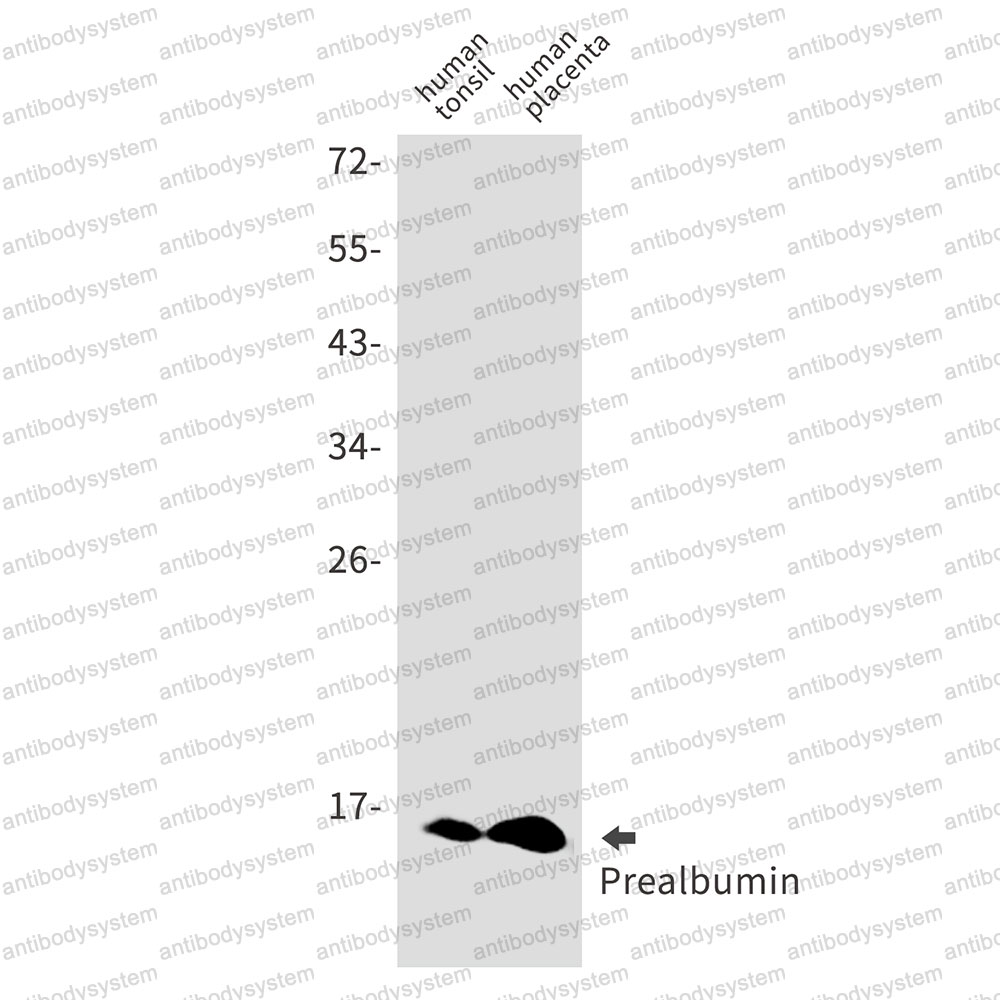 Anti-TTR/Prealbumin/Transthyretin Antibody (R1J14)