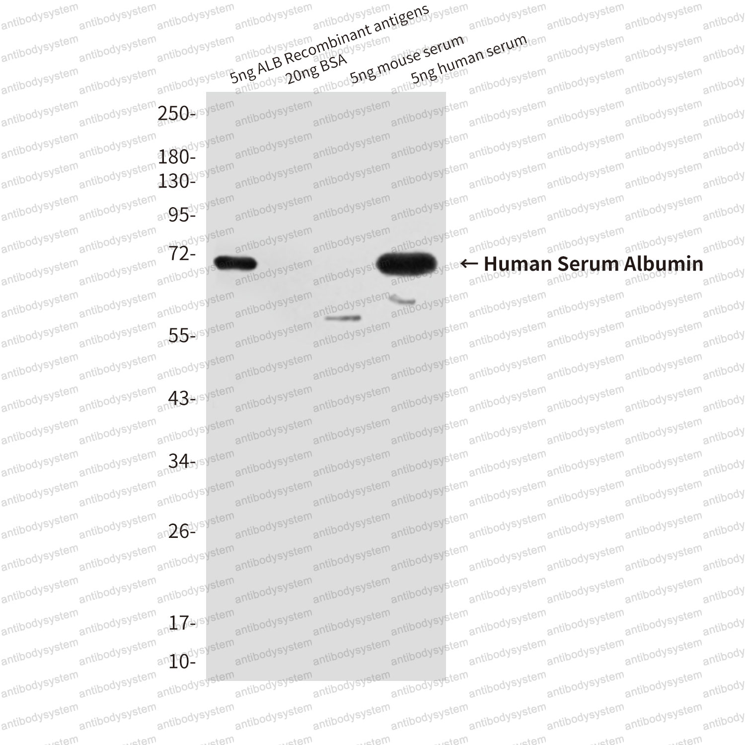 Western blot for Anti-ALB/Albumin/HSA Antibody (R2Y23) ?>