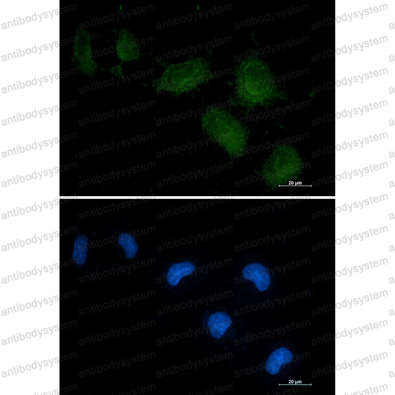 Anti-DBP/GC Antibody (R1J16)