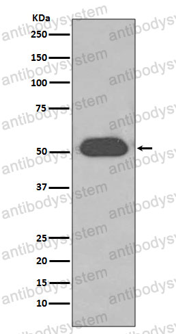 Anti-DBP/GC Antibody (R1J15)