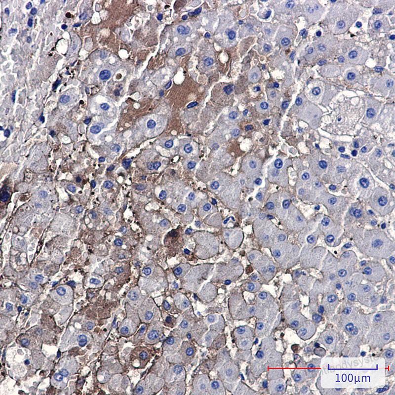 Anti-PF4/CXCL4 Antibody (R1J18)