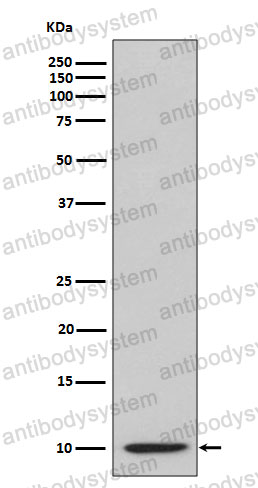 Anti-CXCL10/IP-10 Antibody (R1J19)