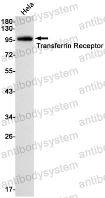 Anti-CD71/TFRC Antibody (R1J20)