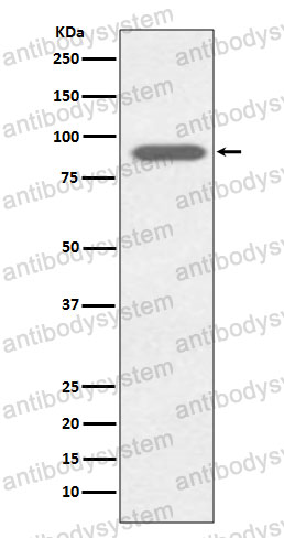 Anti-LTF/Lactoferrin Antibody (R1J22)