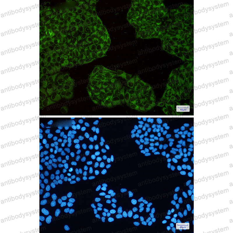 Anti-FTH1 Antibody (R1J27)