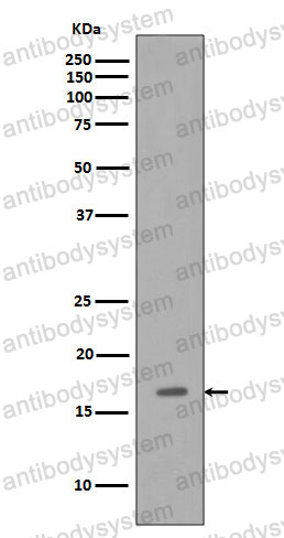 Anti-Osteocalcin/BGLAP/OC Antibody (R1J28)