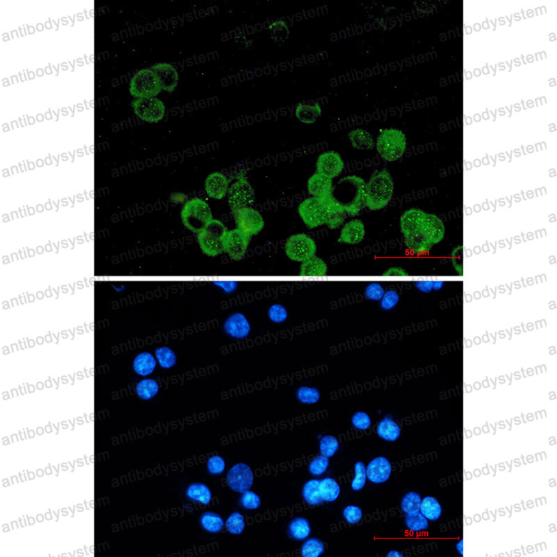 Anti-ESR1/ER-alpha Antibody (R1J29)